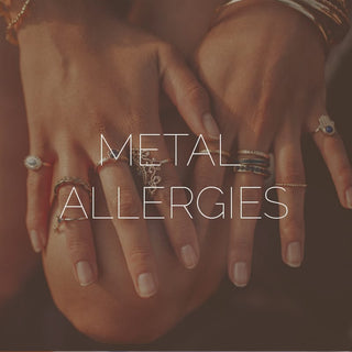 Jewelry & Metal Allergies